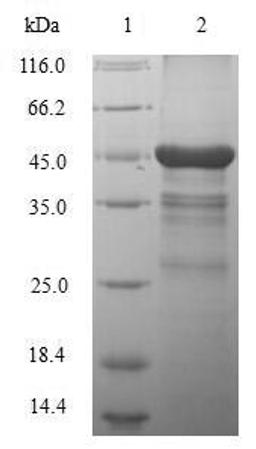 (Tris-Glycine gel) Discontinuous SDS-PAGE (reduced) with 5% enrichment gel and 15% separation gel.
