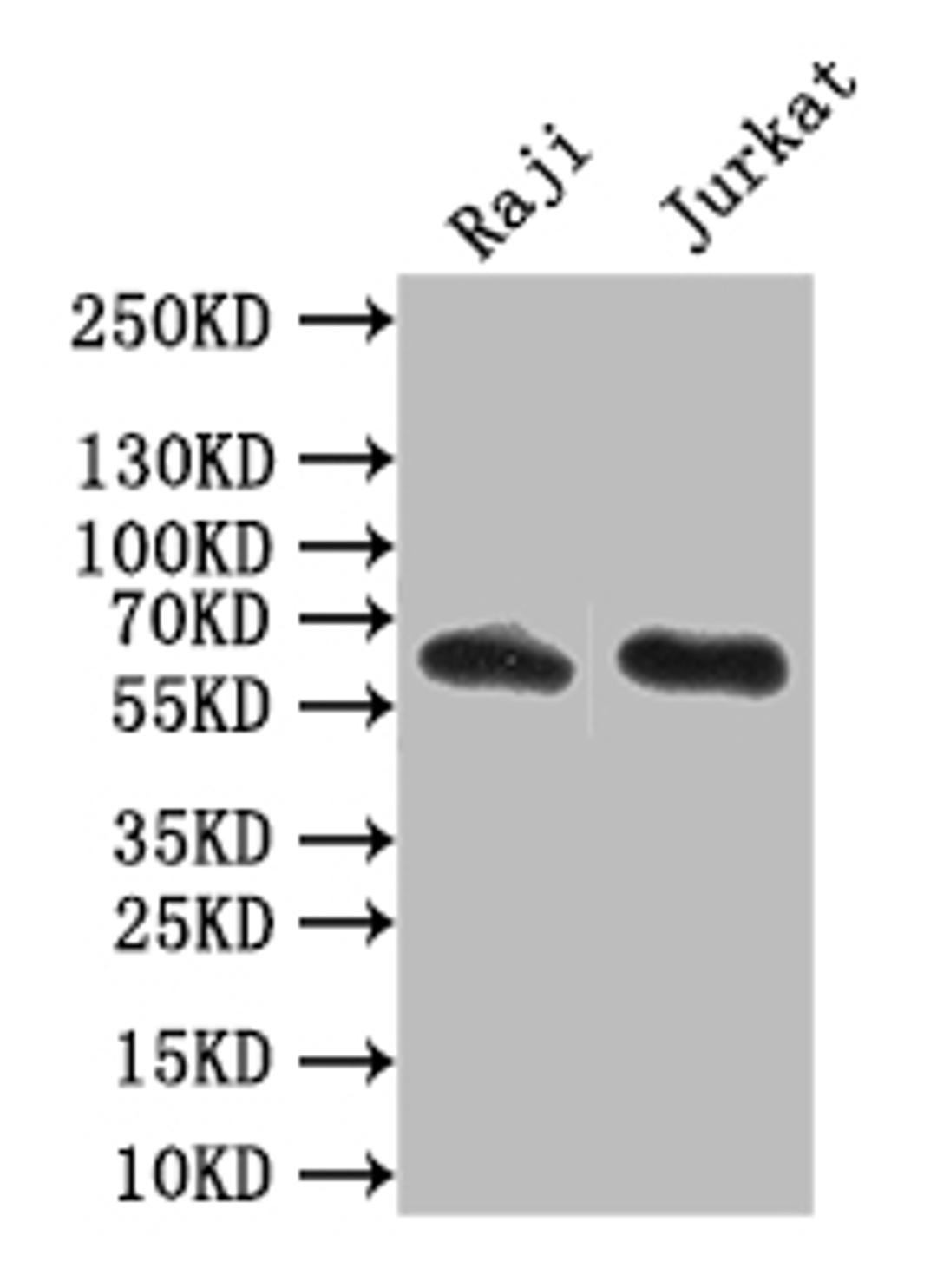 Western Blot. Positive WB detected in: Raji whole cell lysate,JK whole cell lysate. All lanes: CD19 antibody at 1:1000. Secondary. Goat polyclonal to mouse IgG at 1/50000 dilution. Predicted band size: 62 kDa. Observed band size: 62 kDa.