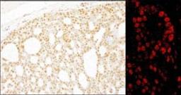 Detection of human Pds5B by immunohistochemistry.