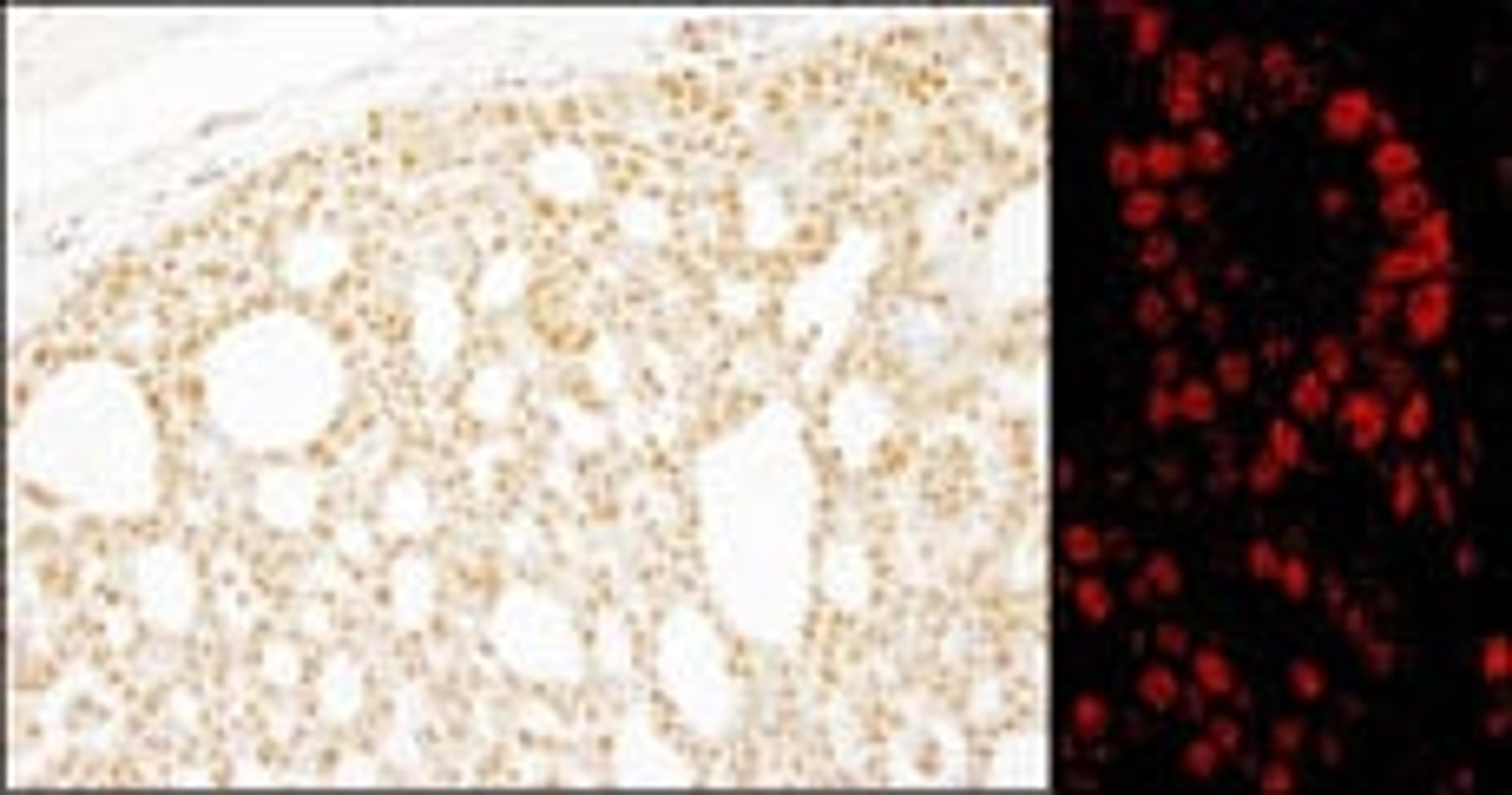 Detection of human Pds5B by immunohistochemistry.