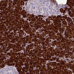 Immunohistochemistry: Salivary Amylase Alpha Antibody [NBP2-46713] - Analysis of human pancreas shows strong cytoplasmic positivity in exocrine glandular cells.