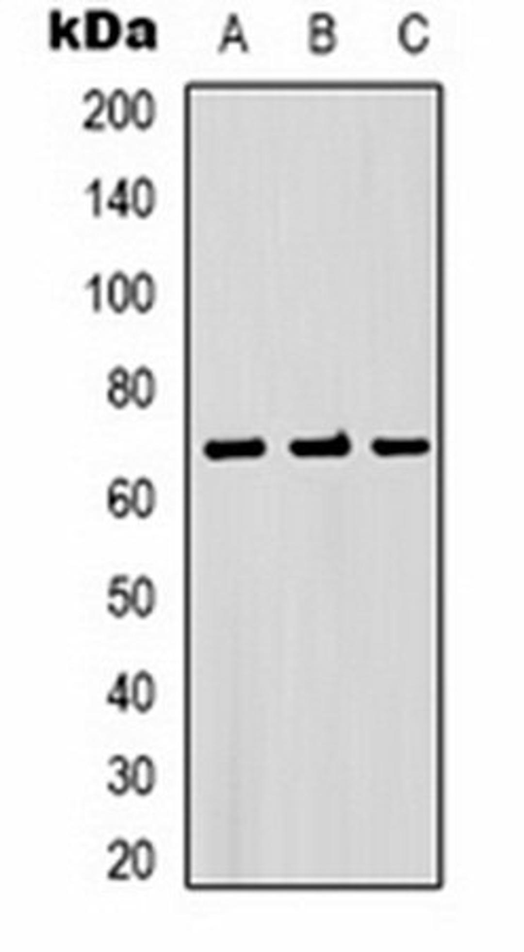 Western blot analysis of PC3 (Lane 1), mouse brain (Lane 2), rat brain (Lane 3) whole cell lysates using Bestrophin-1 antibody