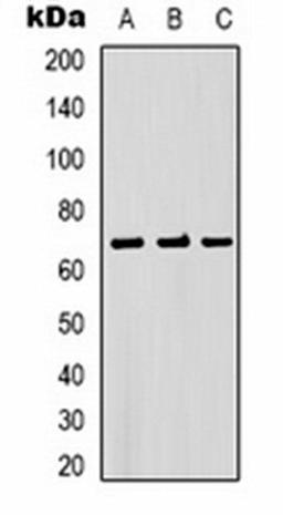 Western blot analysis of PC3 (Lane 1), mouse brain (Lane 2), rat brain (Lane 3) whole cell lysates using Bestrophin-1 antibody