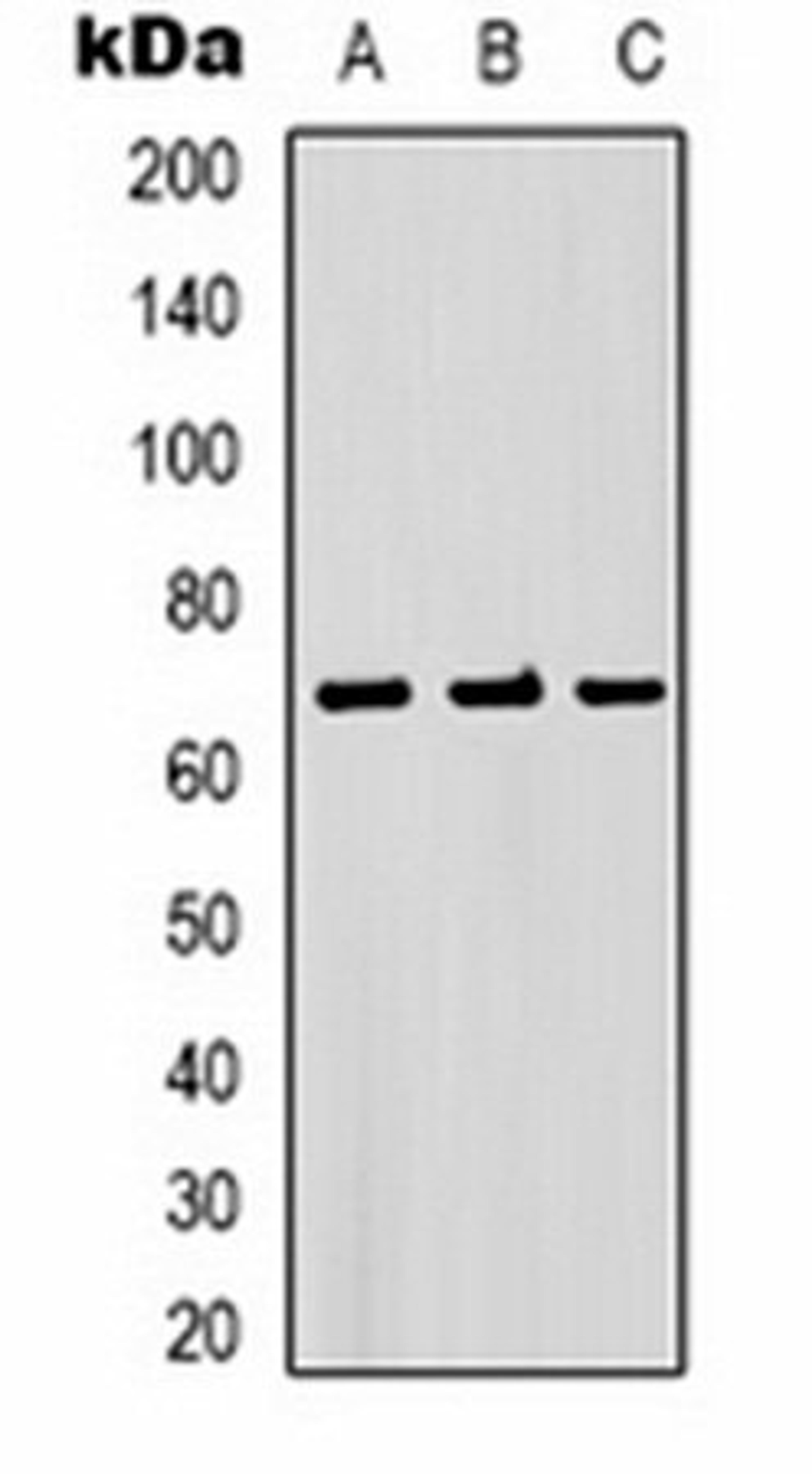 Western blot analysis of PC3 (Lane 1), mouse brain (Lane 2), rat brain (Lane 3) whole cell lysates using Bestrophin-1 antibody