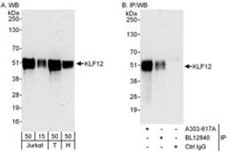 Detection of human KLF12 by western blot and immunoprecipitation.