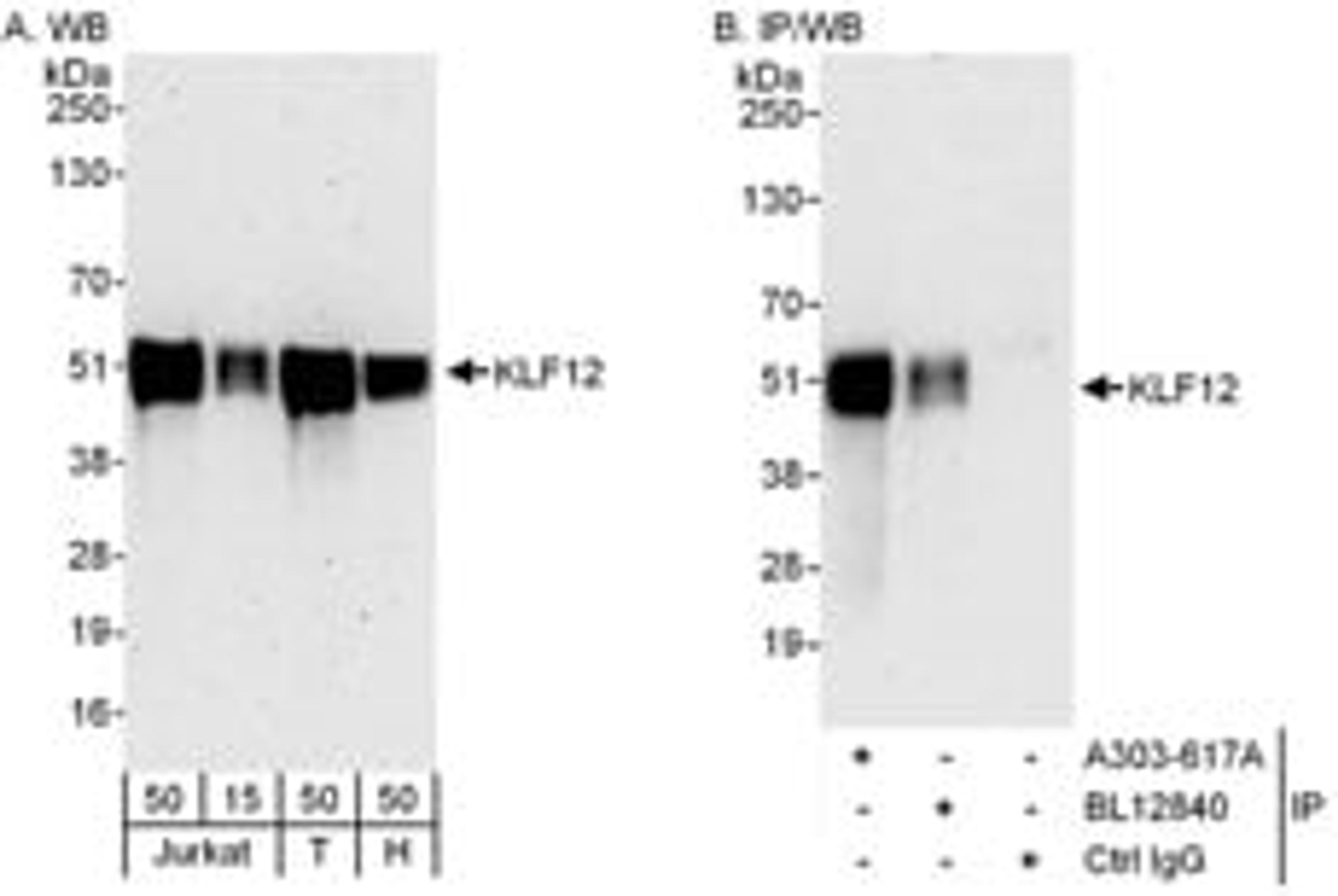 Detection of human KLF12 by western blot and immunoprecipitation.