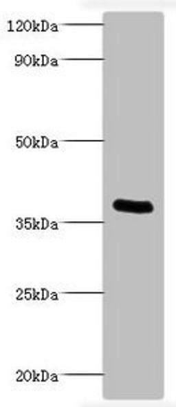 Western blot analysis of recombinant Bordella pertussis pertussis toxin subunit 1