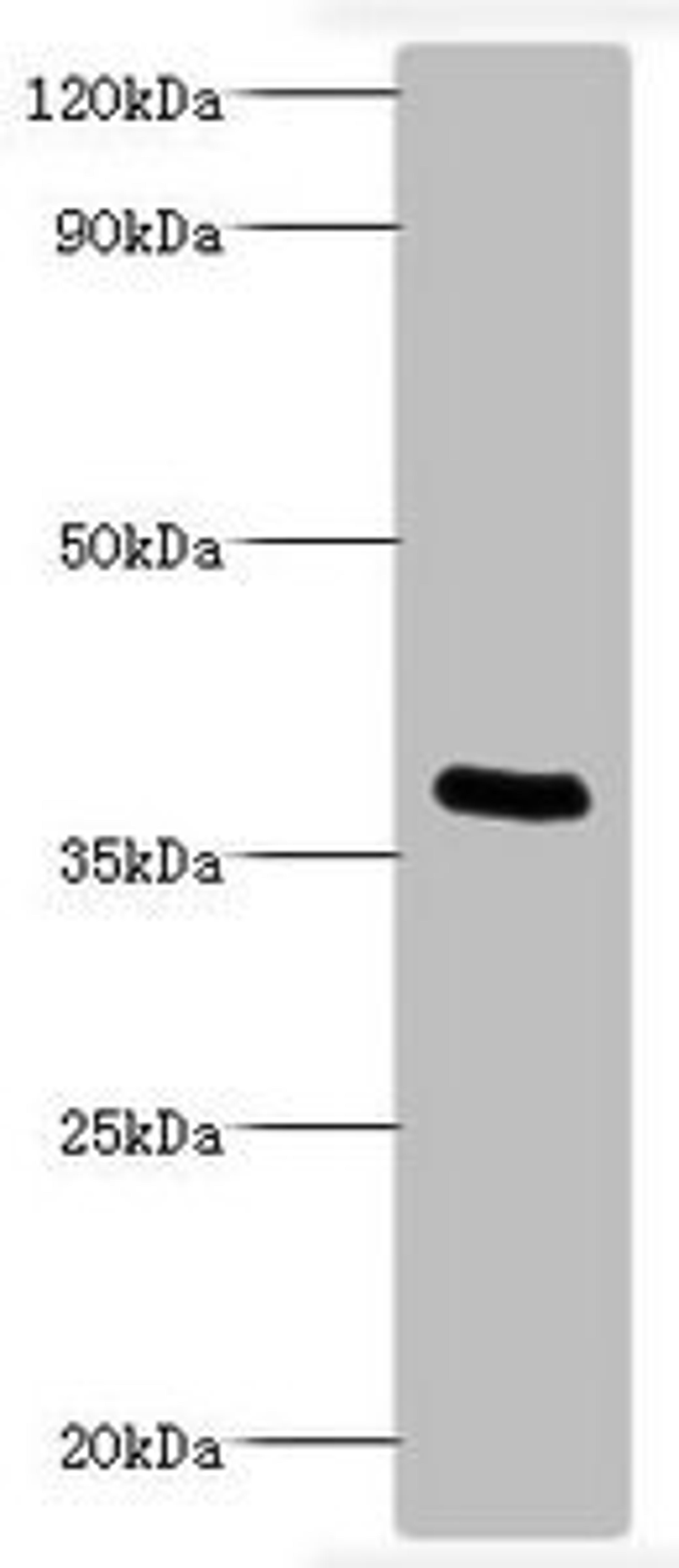 Western blot analysis of recombinant Bordella pertussis pertussis toxin subunit 1