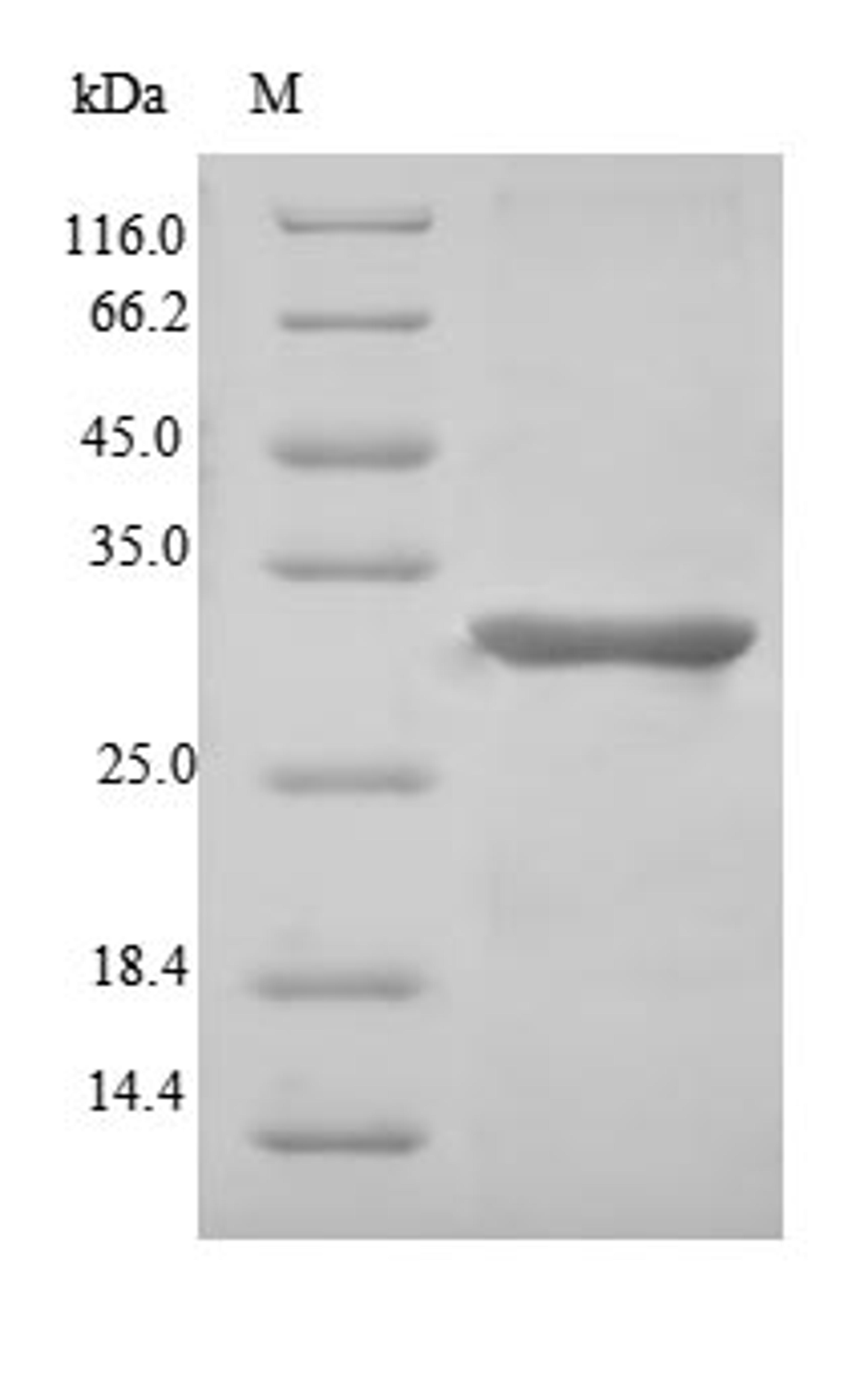 (Tris-Glycine gel) Discontinuous SDS-PAGE (reduced) with 5% enrichment gel and 15% separation gel.