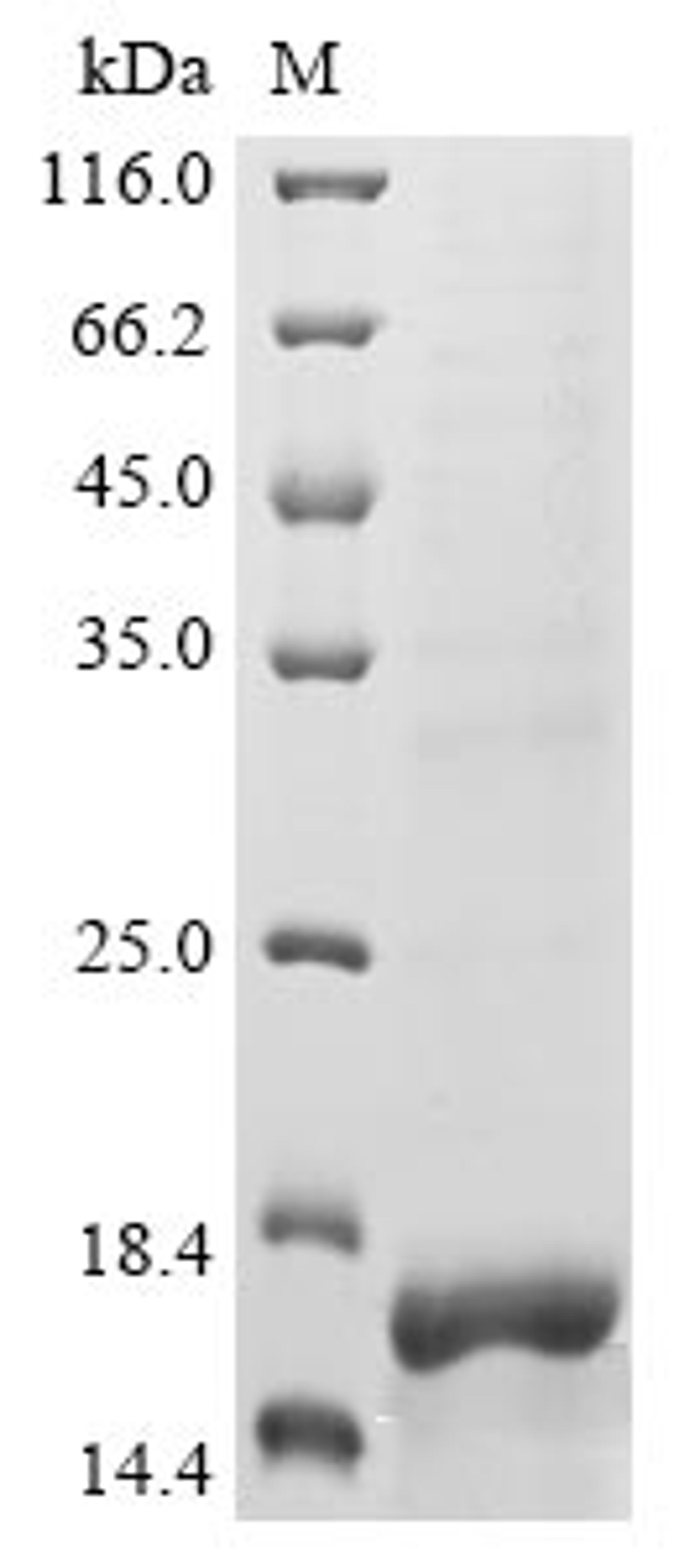 (Tris-Glycine gel) Discontinuous SDS-PAGE (reduced) with 5% enrichment gel and 15% separation gel.