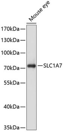 Western blot - SLC1A7 antibody (A10244)