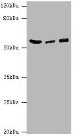 Western blot. All lanes: HARS antibody at 6ug/ml. Lane 1: Hela whole cell lysate. Lane 2: K562 whole cell lysate. Lane 3: 293T whole cell lysate. Secondary. Goat polyclonal to rabbit IgG at 1/10000 dilution. Predicted band size: 58, 53, 51, 55 kDa. Observed band size: 58 kDa.
