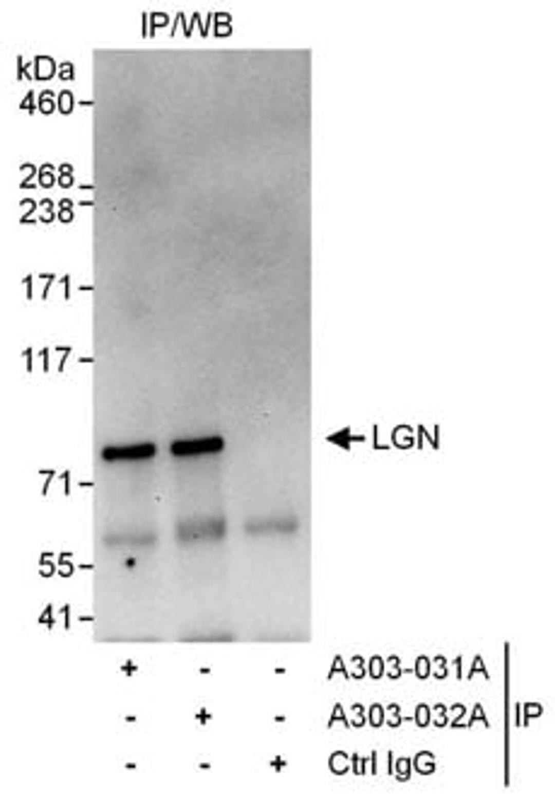 Detection of human LGN by western blot of immunoprecipitates.