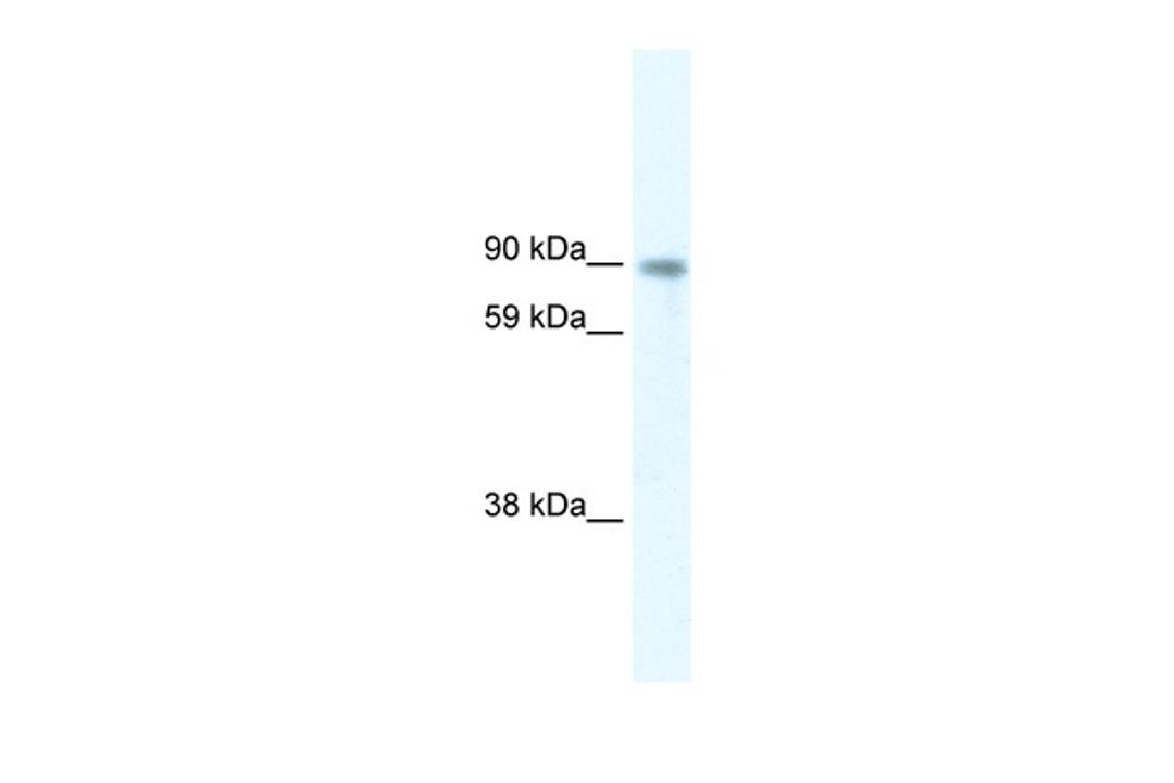 Antibody used in WB on Human at 5.0 ug/ml.