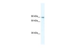 Antibody used in WB on Human at 5.0 ug/ml.