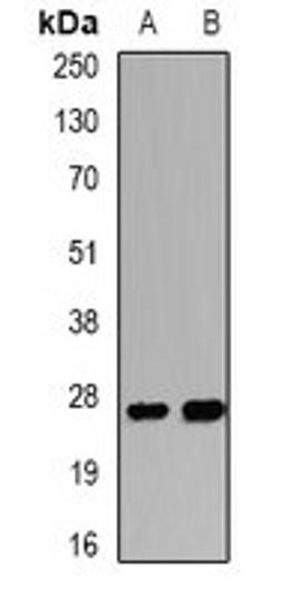 Western blot analysis of Hela (Lane1), mouse lung (Lane2) whole cell lysates using WISP2 antibody