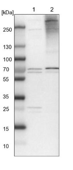 Western Blot: SPAG16 Antibody [NBP1-84124] - Lane 1: NIH-3T3 cell lysate (Mouse embryonic fibroblast cells)<br/>Lane 2: NBT-II cell lysate (Rat Wistar bladder tumour cells)