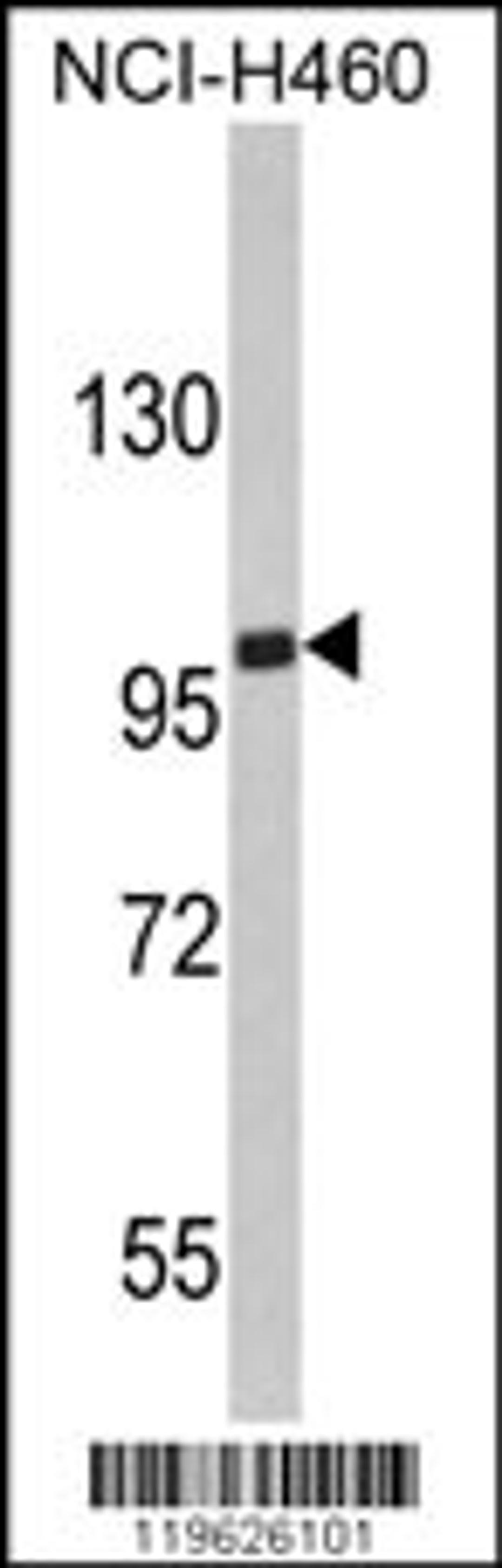 Western blot analysis of EPB41L4B Antibody in NCI-H460 cell line lysates (35ug/lane)(2ug/ml)