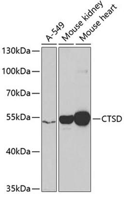 Western blot - CTSD antibody (A1594)