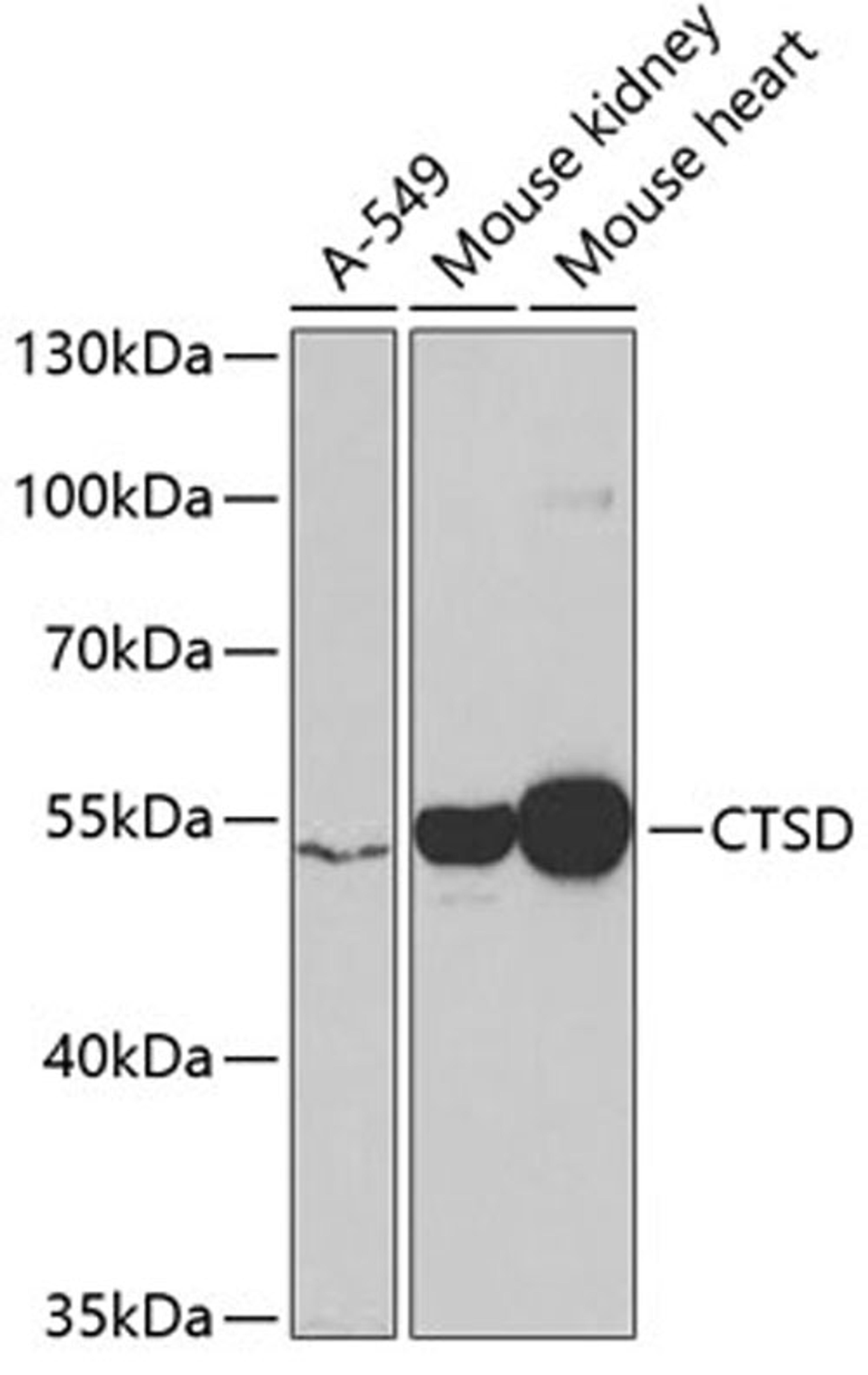 Western blot - CTSD antibody (A1594)