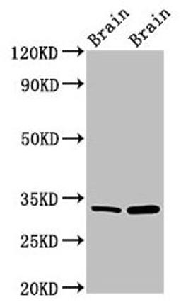 Western Blot. Positive WB detected in: Mouse brain tissue, Rat brain tissue. All lanes: HAX1 antibody at 1.5µg/ml. Secondary. Goat polyclonal to rabbit IgG at 1/50000 dilution. Predicted band size: 32, 33, 29, 15, 27, 22 kDa. Observed band size: 32 kDa
