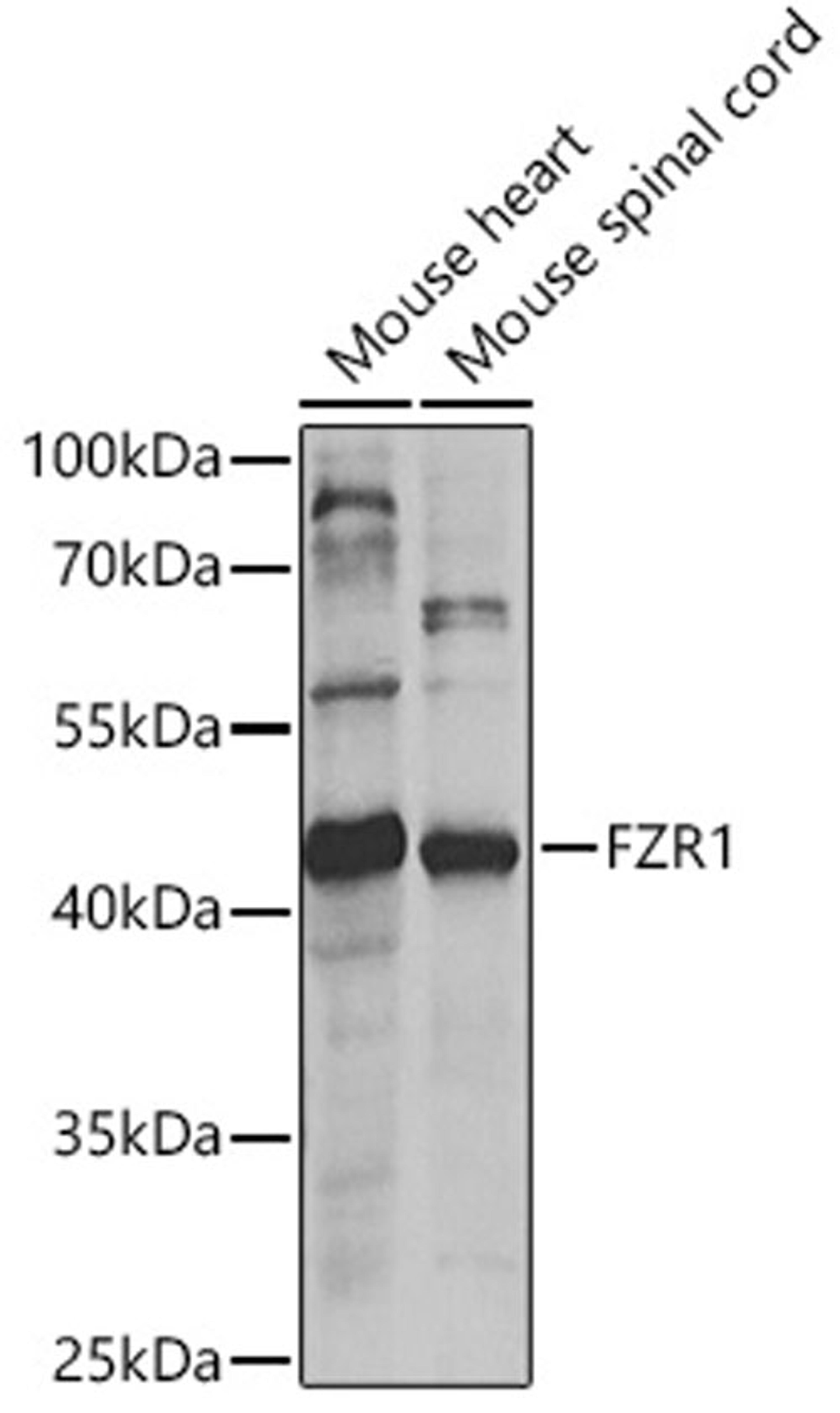 Western blot - FZR1 antibody (A5550)