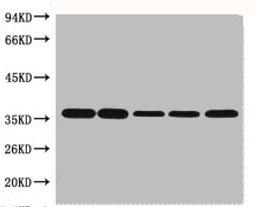 Western blot analysis of Hela (1), Rat brain (2), Rabbit Muscle (3), Sheep Muscle (4), and Mouse brain (5), diluted at 1:10000.