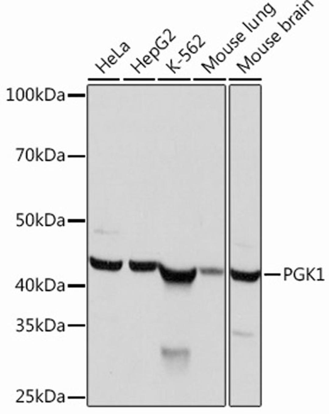 Western blot - PGK1  Rabbit mAb (A12686)