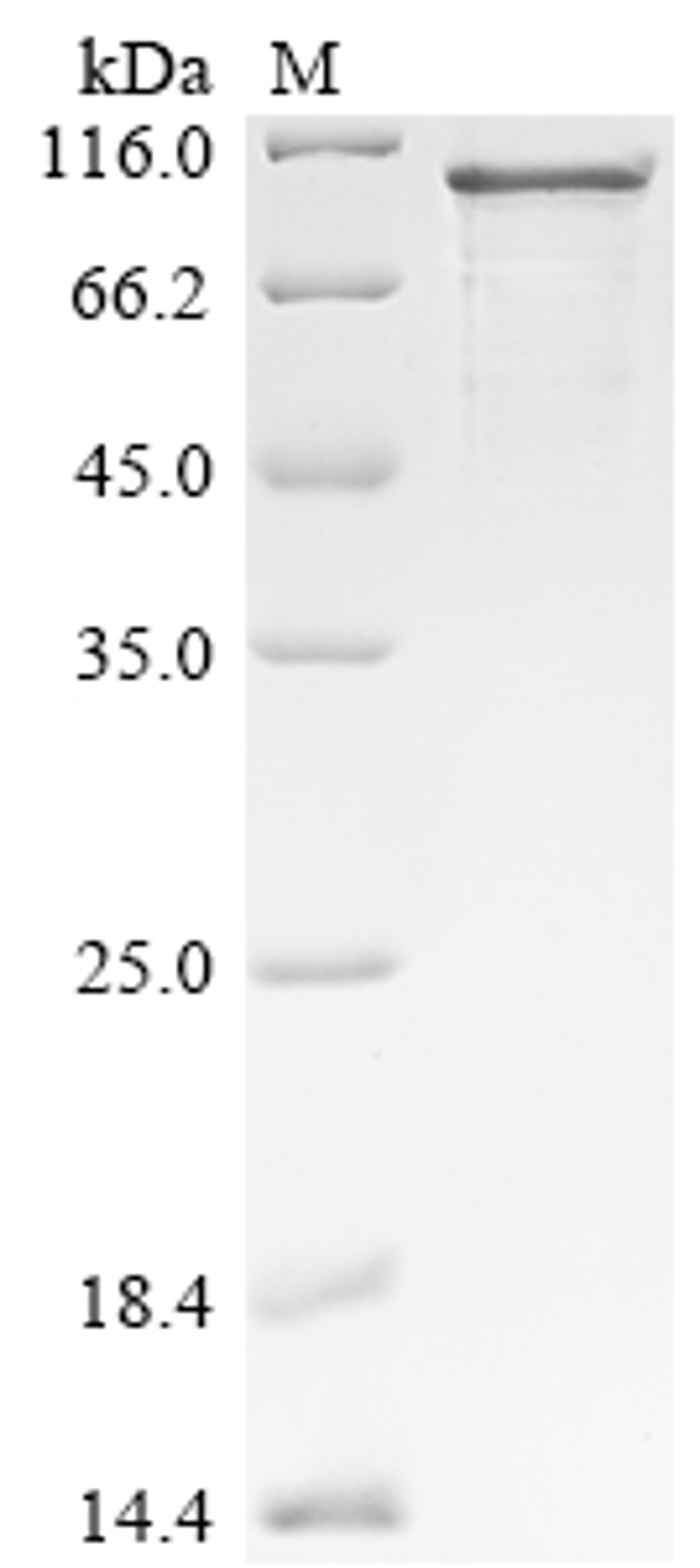 (Tris-Glycine gel) Discontinuous SDS-PAGE (reduced) with 5% enrichment gel and 15% separation gel.