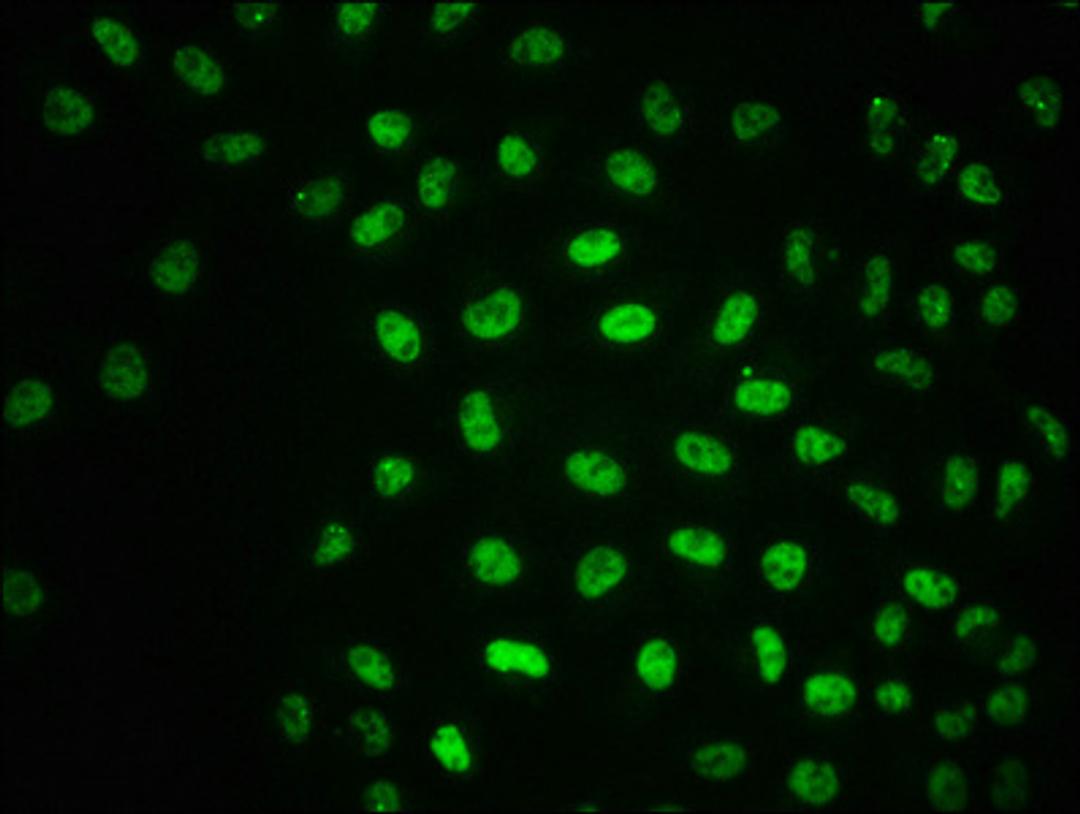 Immunofluorescence staining of Hela cells with CSB-RA618770A1981phHU at 1:100,counter-stained with DAPI. The cells were fixed in 4% formaldehyde, permeabilized using 0.2% Triton X-100 and blocked in 10% normal Goat Serum. The cells were then incubated with the antibody overnight at 4℃. The secondary antibody was Alexa Fluor 488-congugated AffiniPure Goat Anti-Rabbit IgG (H+L).