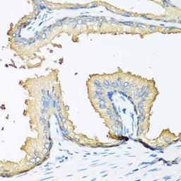 Immunohistochemical staining of human prostate tissue using NOV antibody (dilution of 1:100)