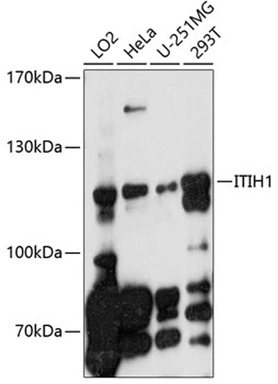 Western blot - ITIH1 antibody (A10833)