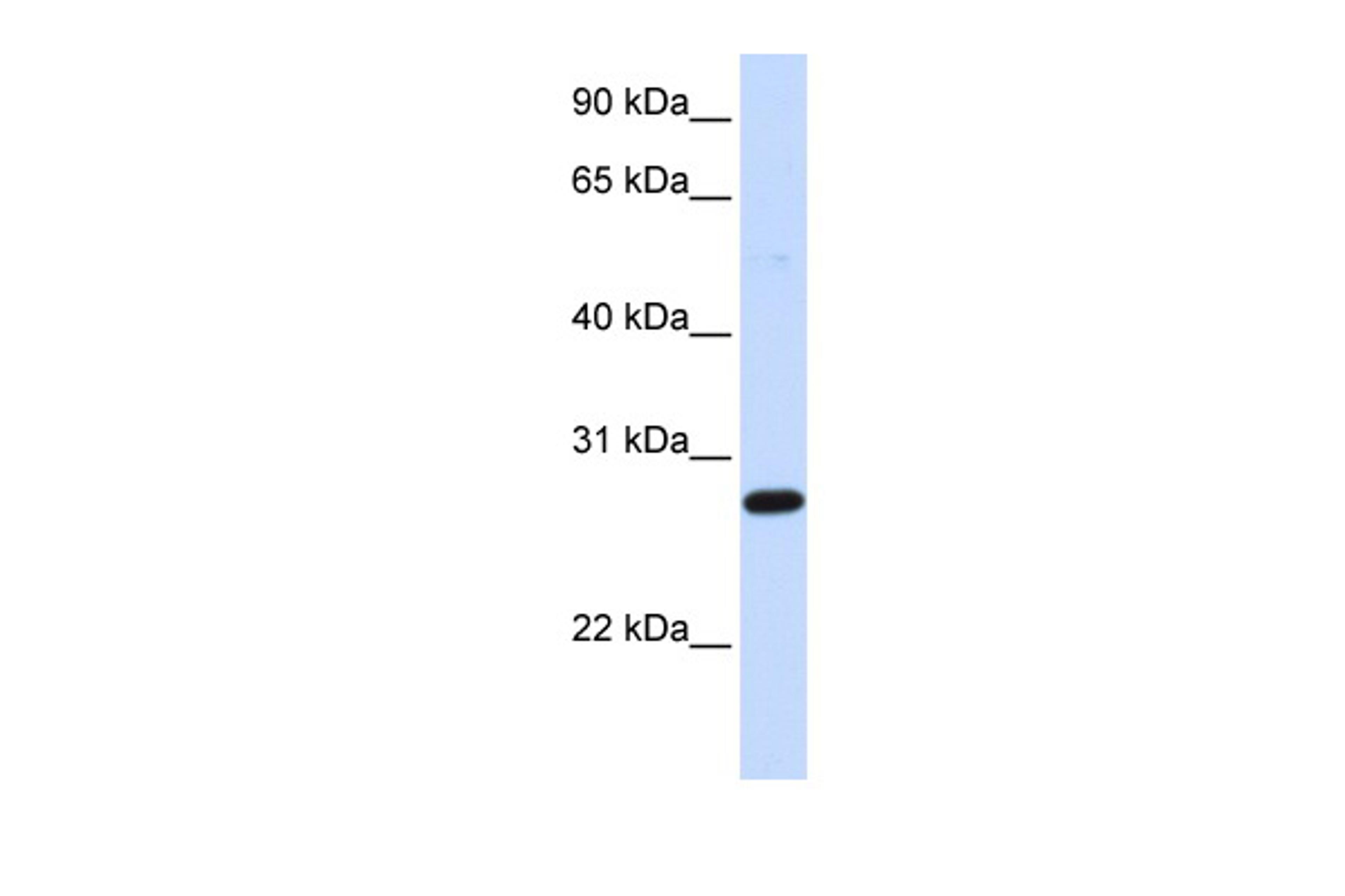 Antibody used in WB on Human Heart at 0.2-1 ug/ml.