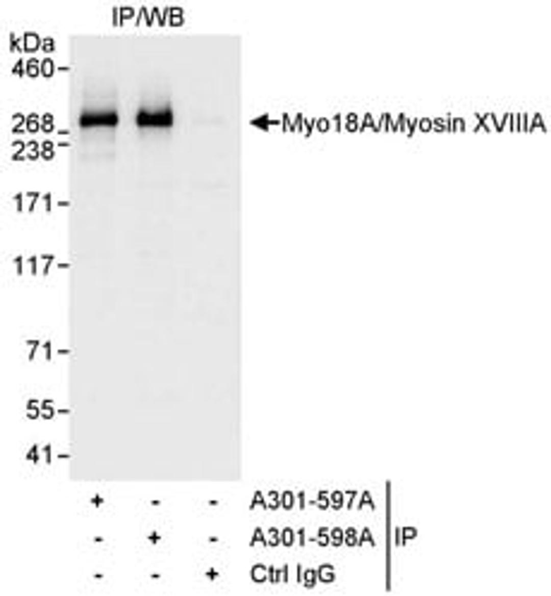 Detection of human Myo18A/Myosin XVIIIA by western blot of immunoprecipitates.