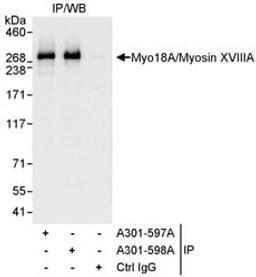 Detection of human Myo18A/Myosin XVIIIA by western blot of immunoprecipitates.