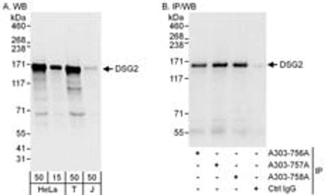 Detection of human DSG2 by western blot and immunoprecipitation.