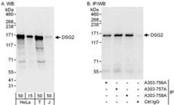 Detection of human DSG2 by western blot and immunoprecipitation.