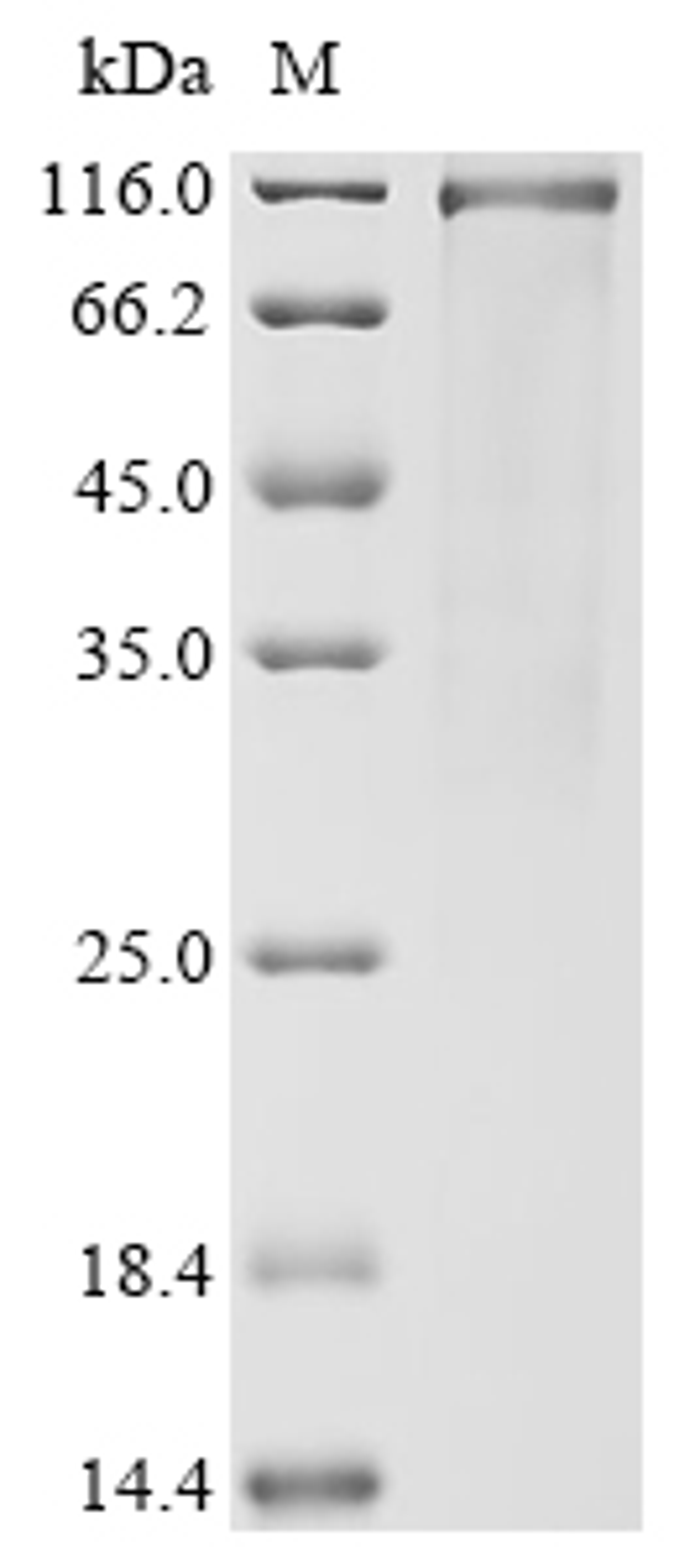 (Tris-Glycine gel) Discontinuous SDS-PAGE (reduced) with 5% enrichment gel and 15% separation gel.