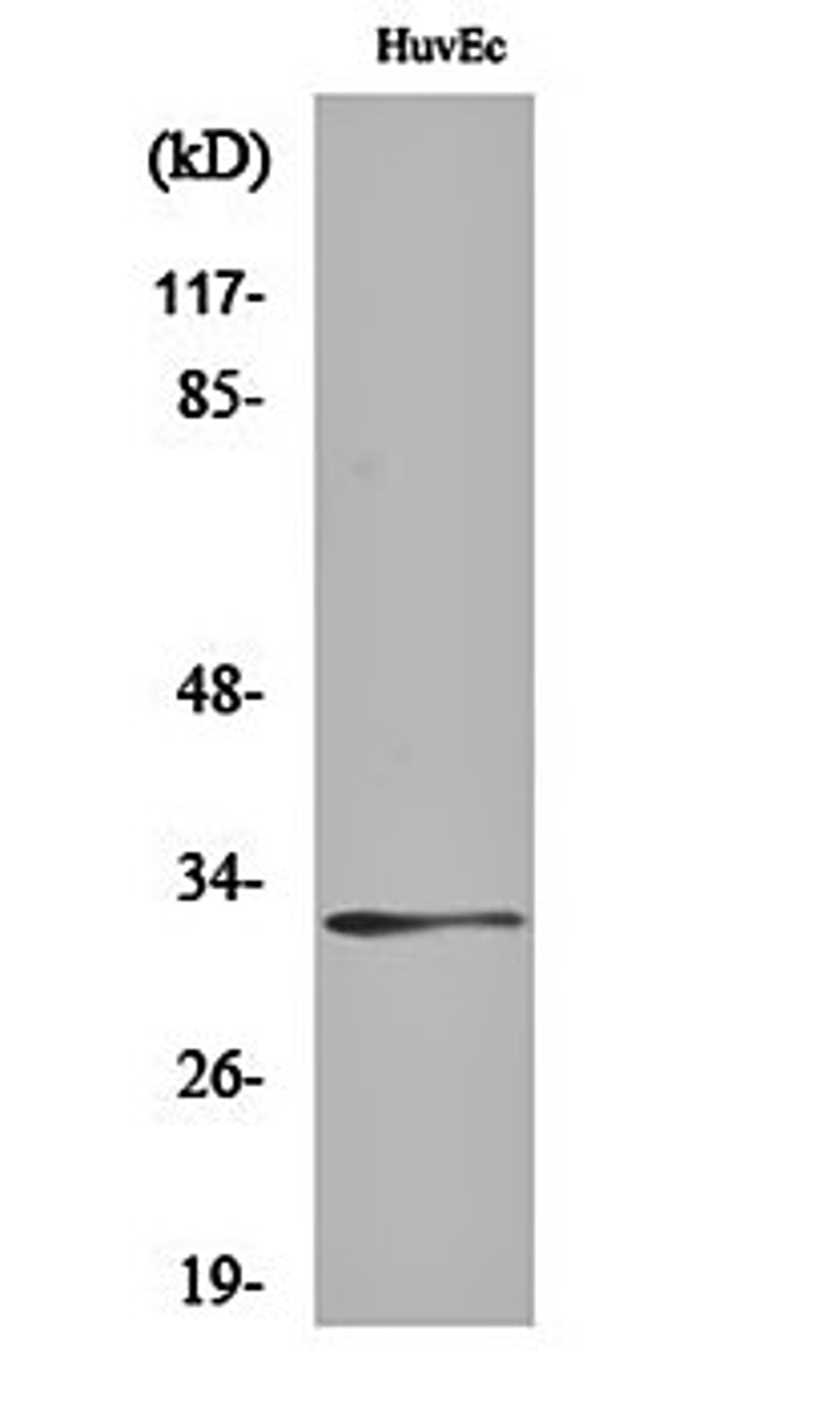 Western blot analysis of HuvEc cell lysates using Ribosomal Protein S6 antibody