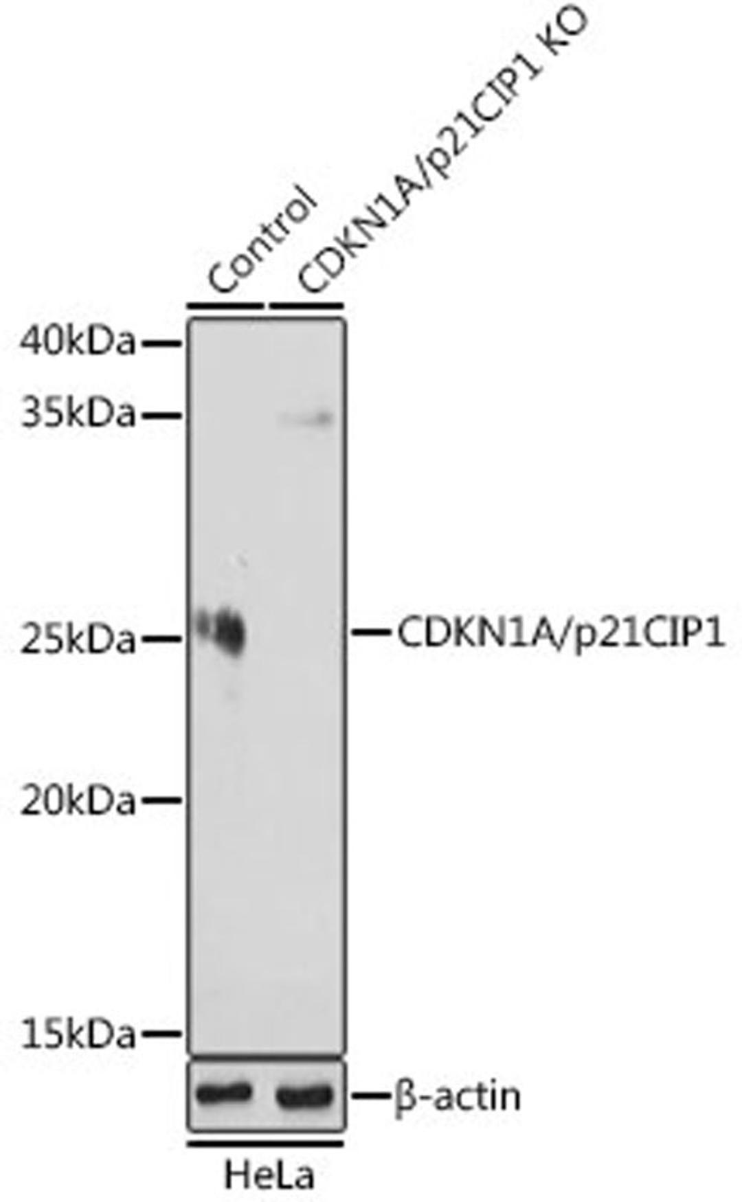 Western blot - CDKN1B/p27KIP1 antibody (A19095)