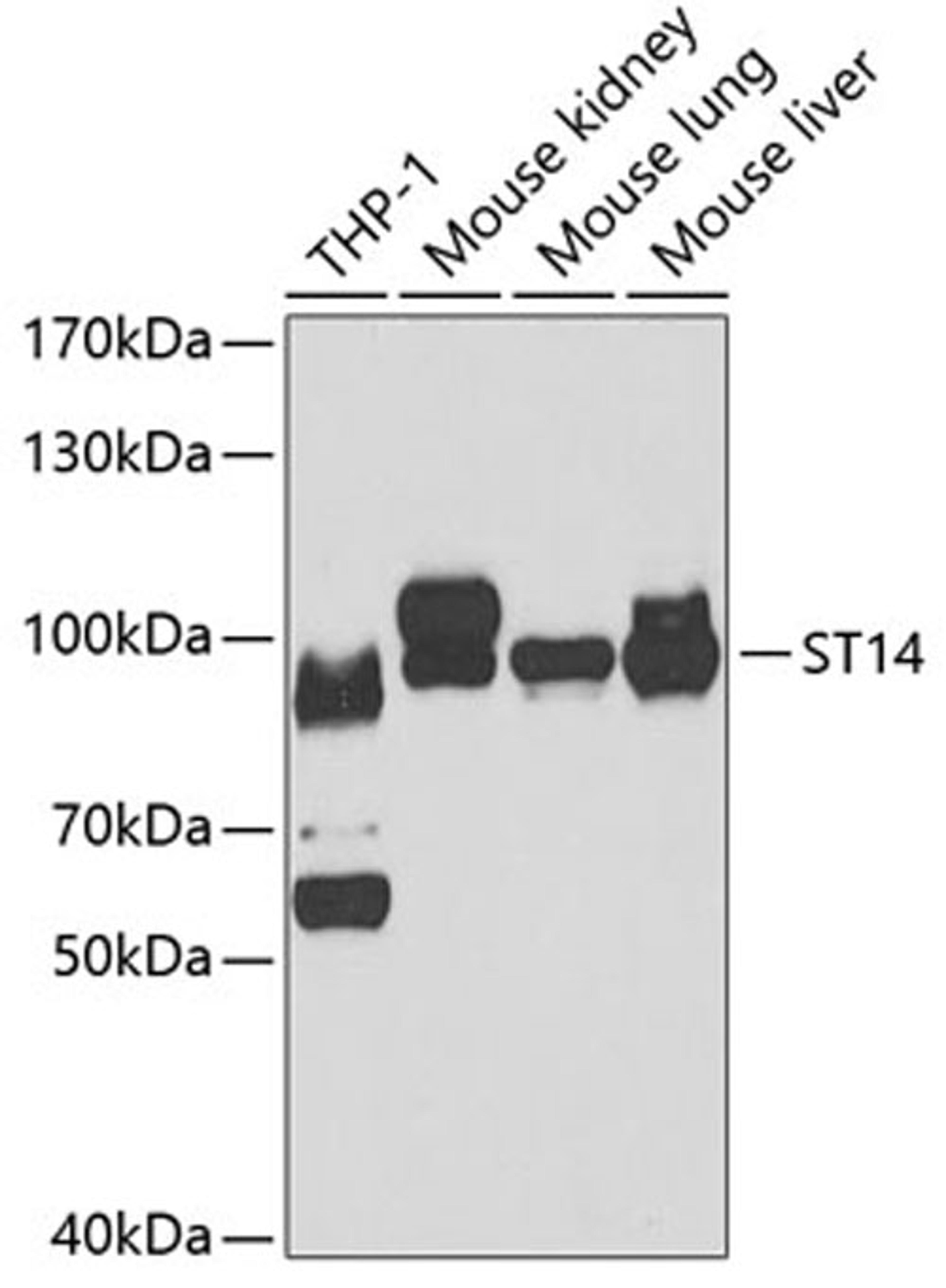 Western blot - ST14 antibody (A6135)