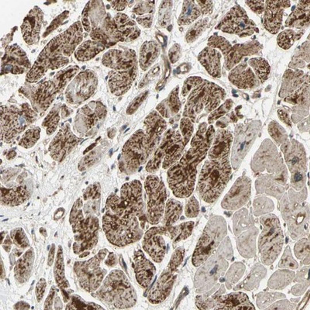 Immunohistochemistry-Paraffin: Ephrin B2 Antibody [NBP1-84830] - Staining of human heart muscle shows strong cytoplasmic positivity in myocytes.