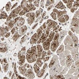 Immunohistochemistry-Paraffin: Ephrin B2 Antibody [NBP1-84830] - Staining of human heart muscle shows strong cytoplasmic positivity in myocytes.