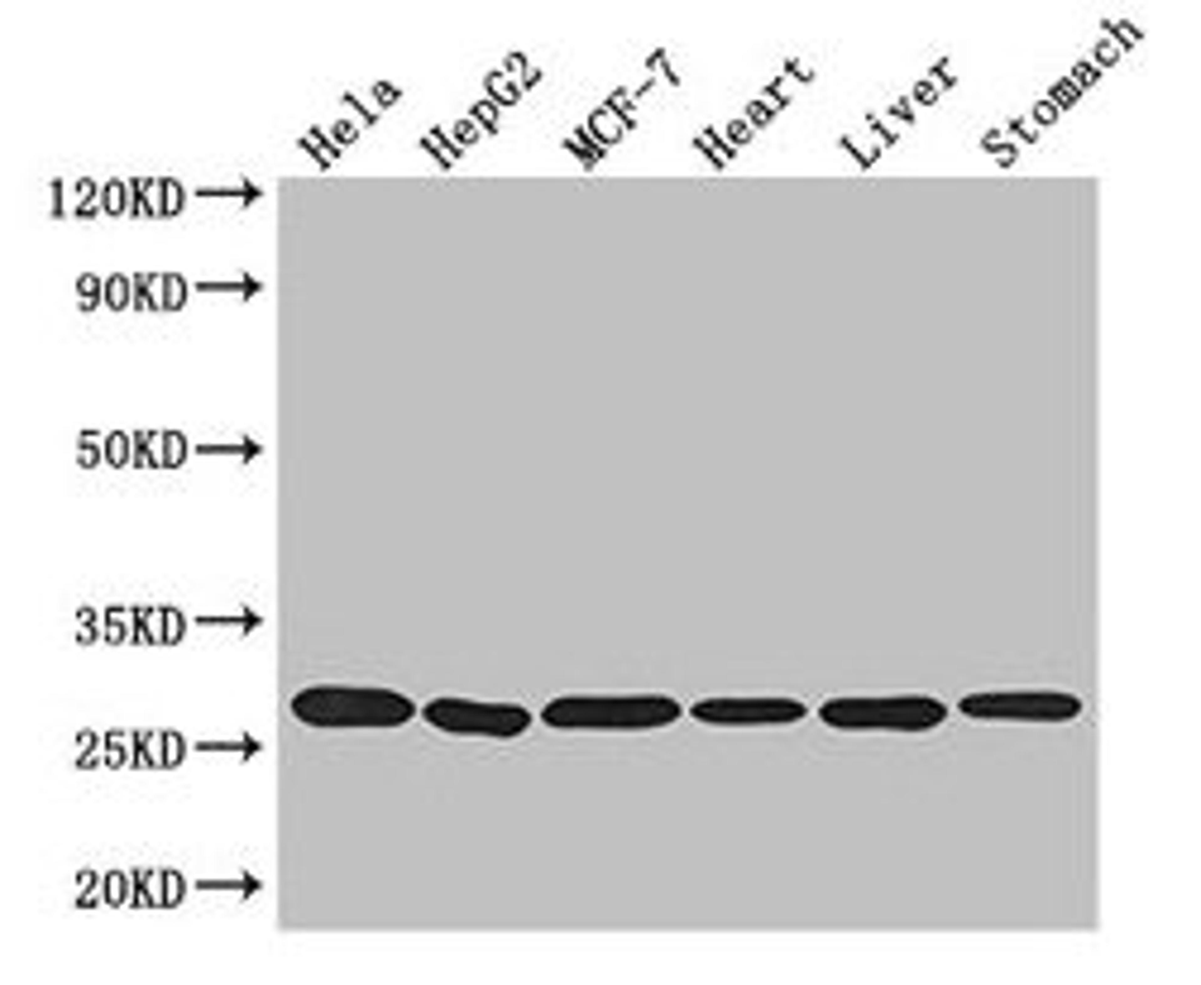 Western Blot. Positive WB detected in: Hela whole cell lysate, HepG2 whole cell lysate, MCF-7 whole cell lysate, Mouse heart tissue, Mouse liver tissue, Mouse stomach tissue. All lanes: PRDX3 antibody at 3.2µg/ml. Secondary. Goat polyclonal to rabbit IgG at 1/50000 dilution. Predicted band size: 28, 26 kDa. Observed band size: 28 kDa