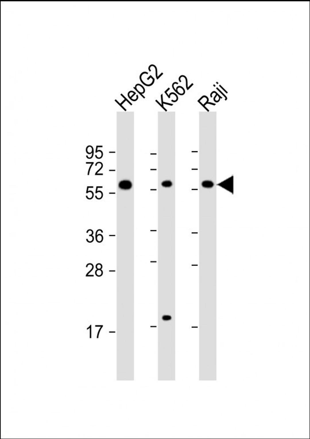 Western Blot at 1:2000 dilution Lane 1: HepG2 whole cell lysate Lane 2: K562 whole cell lysate Lane 3: Raji whole cell lysate Lysates/proteins at 20 ug per lane.