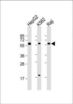 Western Blot at 1:2000 dilution Lane 1: HepG2 whole cell lysate Lane 2: K562 whole cell lysate Lane 3: Raji whole cell lysate Lysates/proteins at 20 ug per lane.