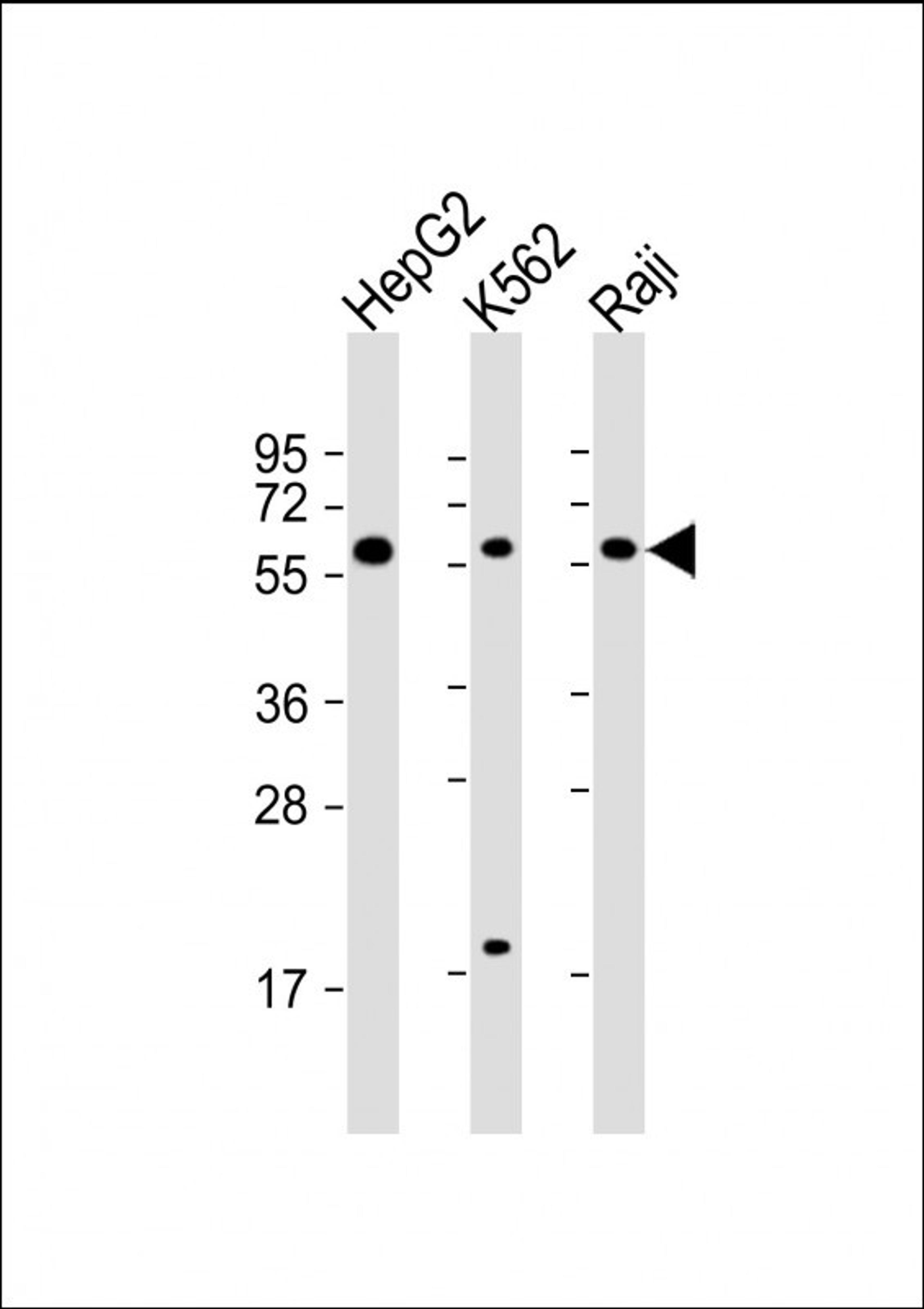 Western Blot at 1:2000 dilution Lane 1: HepG2 whole cell lysate Lane 2: K562 whole cell lysate Lane 3: Raji whole cell lysate Lysates/proteins at 20 ug per lane.