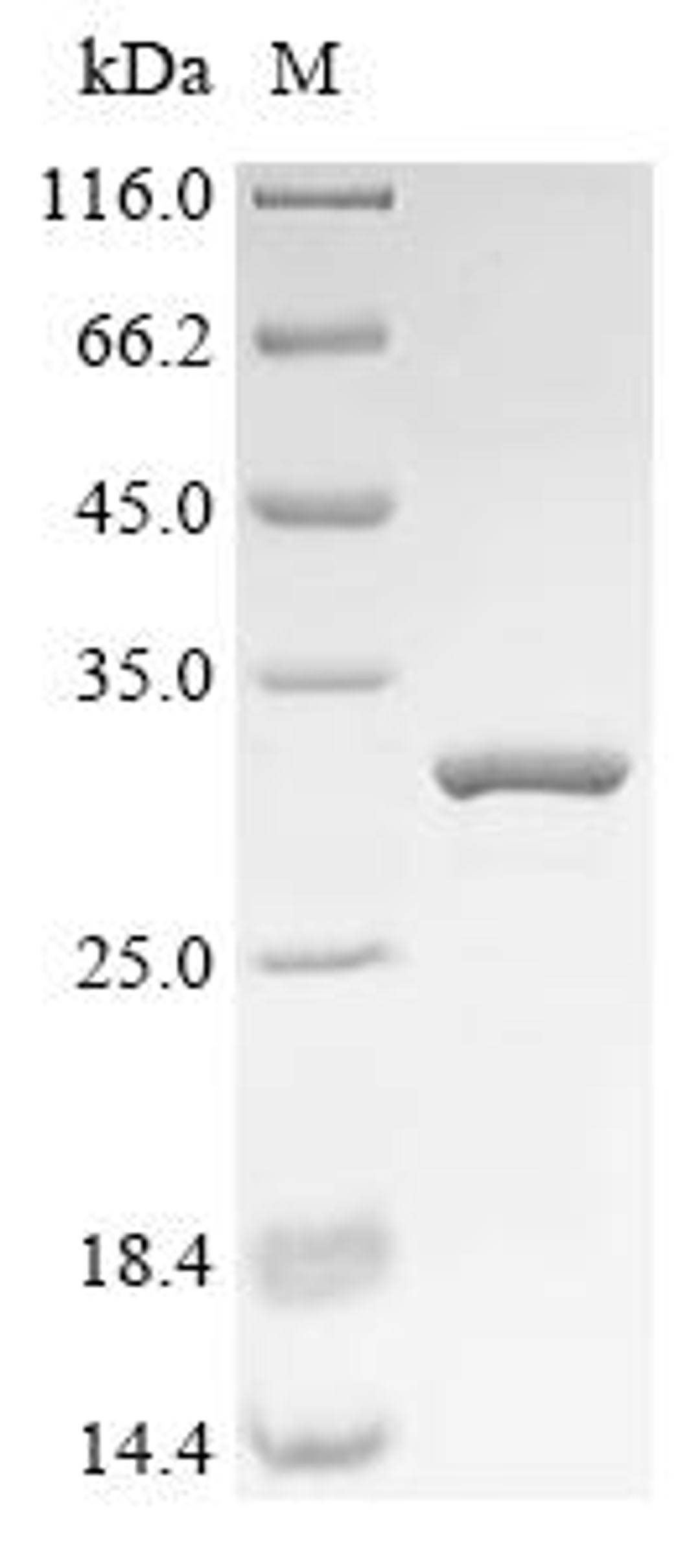 (Tris-Glycine gel) Discontinuous SDS-PAGE (reduced) with 5% enrichment gel and 15% separation gel.