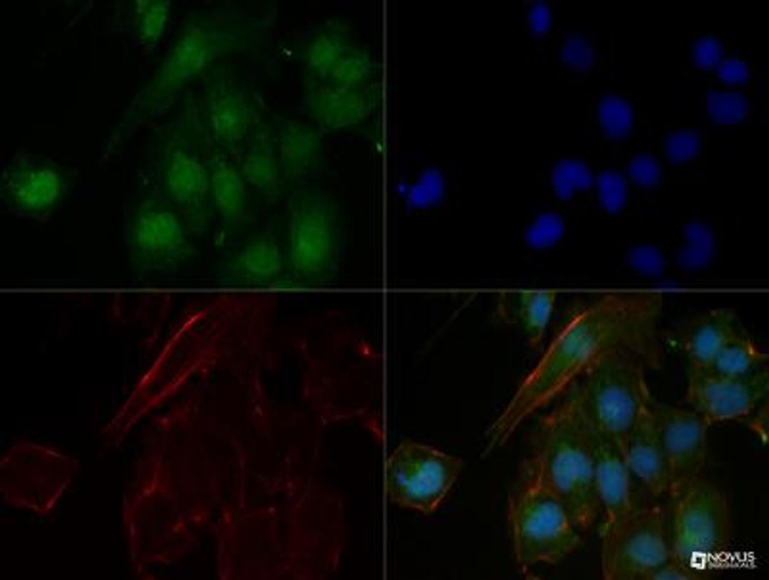 Immunocytochemistry/ Immunofluorescence: n-Myc Antibody (NMYC-1) [NB200-109] - The n-Myc (NMYC-1) antibody was tested in NTERA2 cells at a 1:50 dilution against Dylight 488 (Green). Actin and nuclei were counterstained against Phalloidin 568 (Red) and DAPI (Blue), respectively.