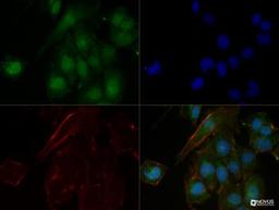 Immunocytochemistry/ Immunofluorescence: n-Myc Antibody (NMYC-1) [NB200-109] - The n-Myc (NMYC-1) antibody was tested in NTERA2 cells at a 1:50 dilution against Dylight 488 (Green). Actin and nuclei were counterstained against Phalloidin 568 (Red) and DAPI (Blue), respectively.